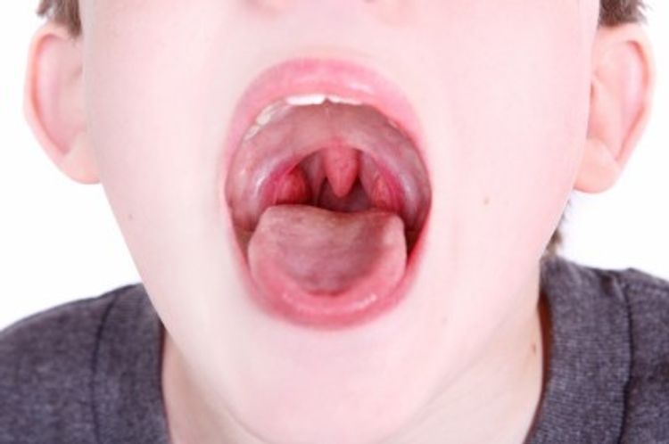 Patches disappear from when strep white throat will the White Spots